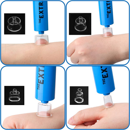 Snake Bite Kit, Bee Sting Kit, Emergency First Aid Supplies, Venom Extractor Suction Pump, Bite and Sting First Aid for Hiking, Backpacking and Camping. Includes Bonus CPR Face Shield (Blue) - Tanks Treasures